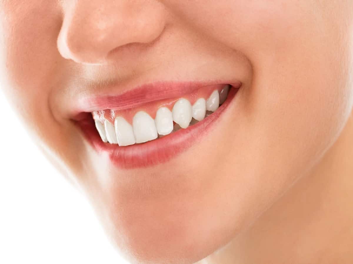 Try These Natural Home Remedies For Teeth Whitening
